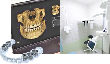 歯科用CTを用いた正確な診査・診断