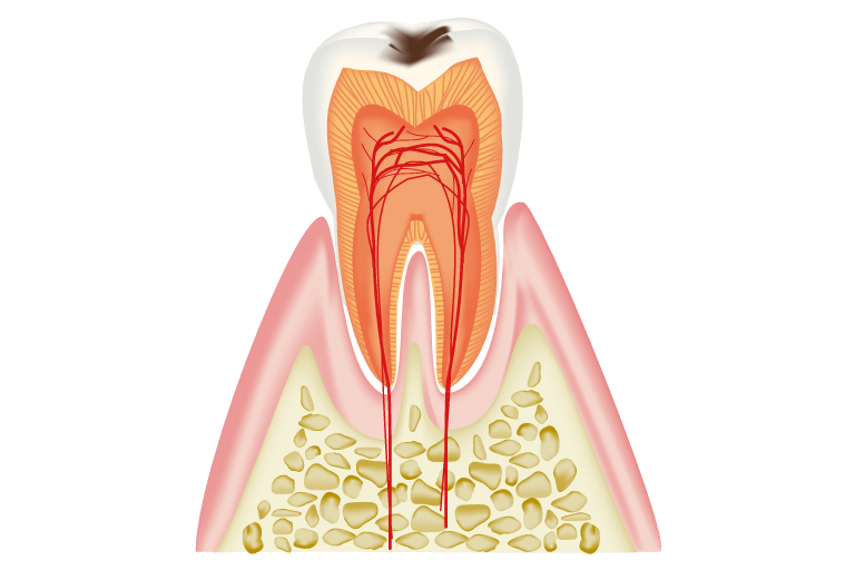 C1